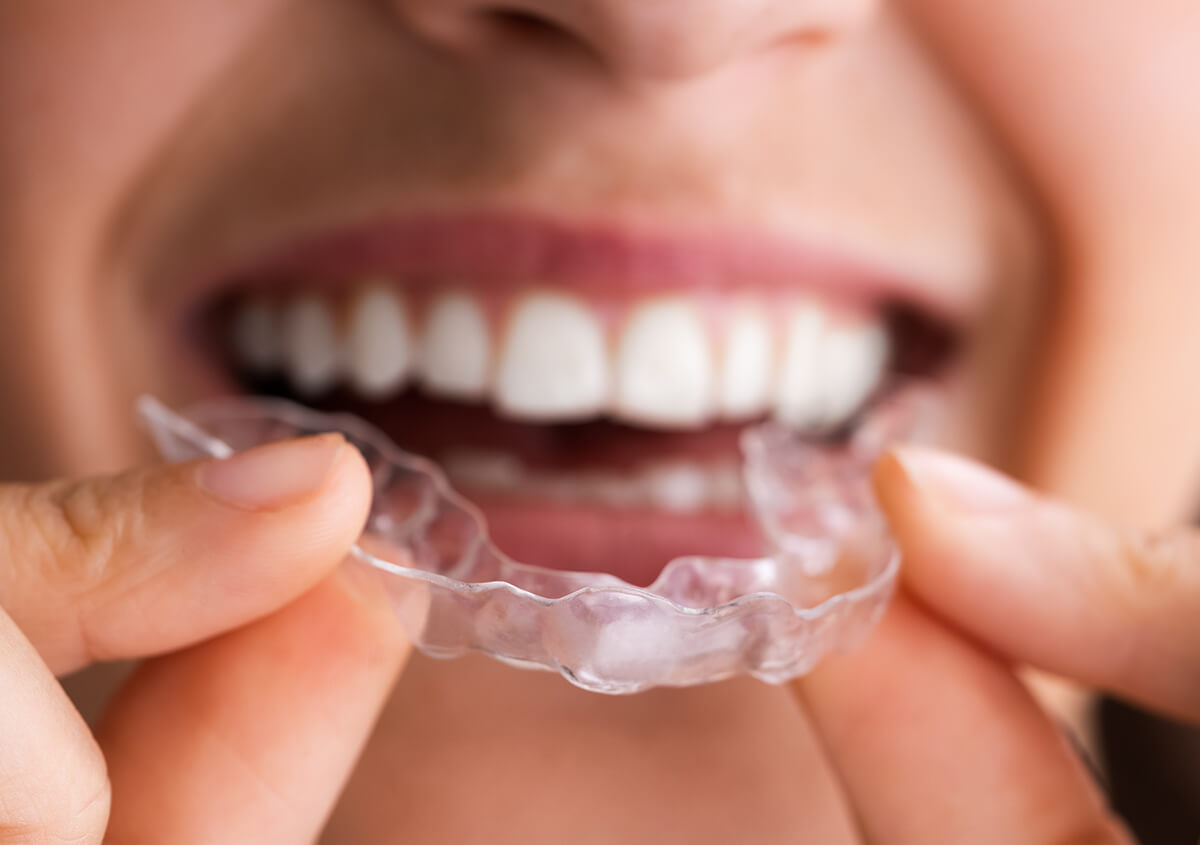 Invisalign Clear Aligners Coppell TX - Teeth Straightening